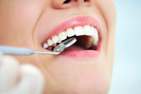 The Importance of Regular Dental Checkups