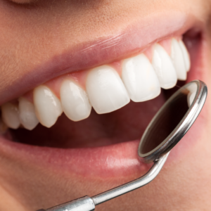 big smile with dental mirror