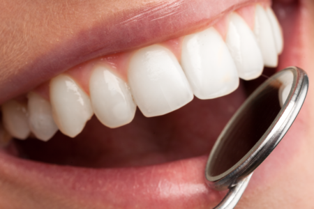 After COVID-19: What to look for in Family Dentistry in North Bethesda