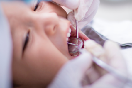 Pediatric Dentistry: The Importance of Bringing Your Kids Early to the Dentist