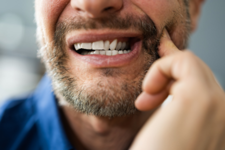 What are the Common Symptoms of Tooth Decay?